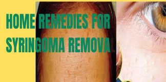 home-remedies-for-syringoma-removal