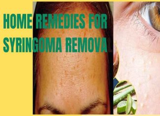 home-remedies-for-syringoma-removal