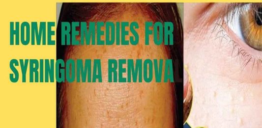 home-remedies-for-syringoma-removal