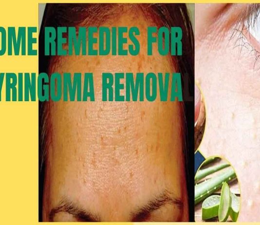 home-remedies-for-syringoma-removal